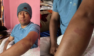 पत्रकार रानामाथीको आक्रमण प्रति महासँघको गम्भीर ध्यानाकर्षण
